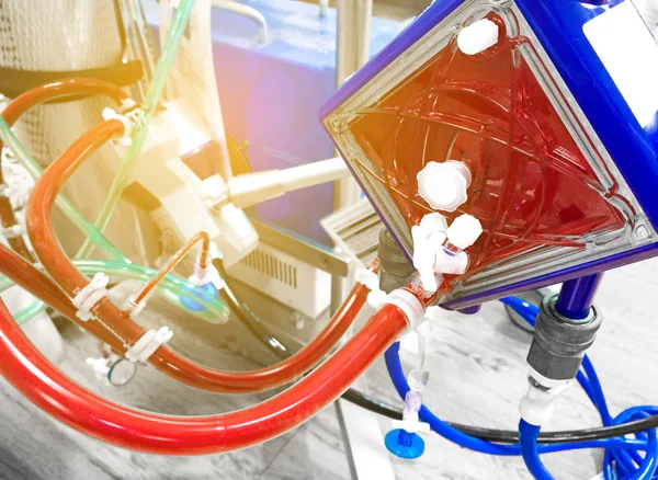 Ciddi derecede hasta pati içinde ekstrakorporeal zar oksijeni (Ecmo)