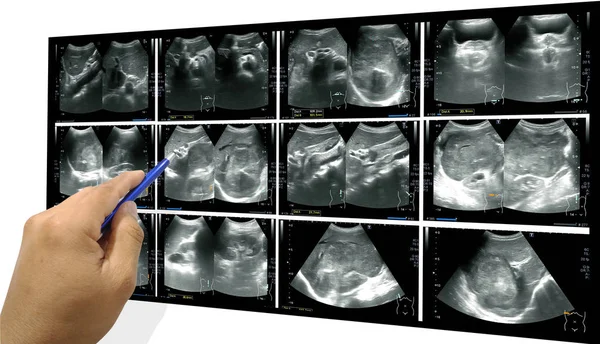 Ultraschall des ganzen Bauches — Stockfoto