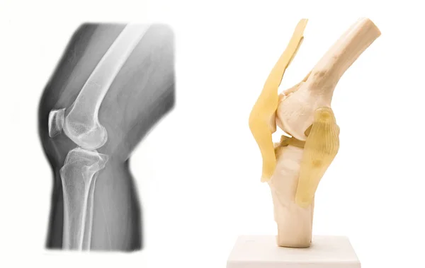 Artificial modelo de articulación de rodilla humana en médico —  Fotos de Stock