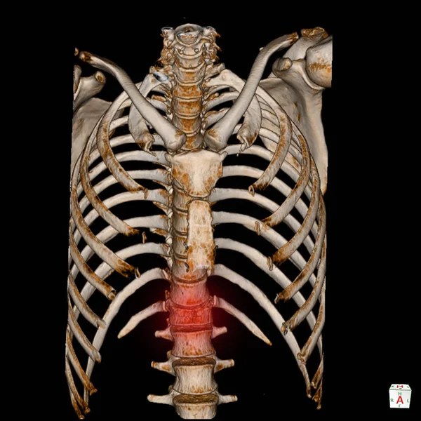 CT Scan 3D renderizar el sistema de esqueleto humano (esqueleto torácico ) —  Fotos de Stock