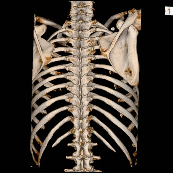 Ct Scan 3d καθιστούν το ανθρώπινο σκελετικό σύστημα (Θωρακικός σκελετός) . — Φωτογραφία Αρχείου