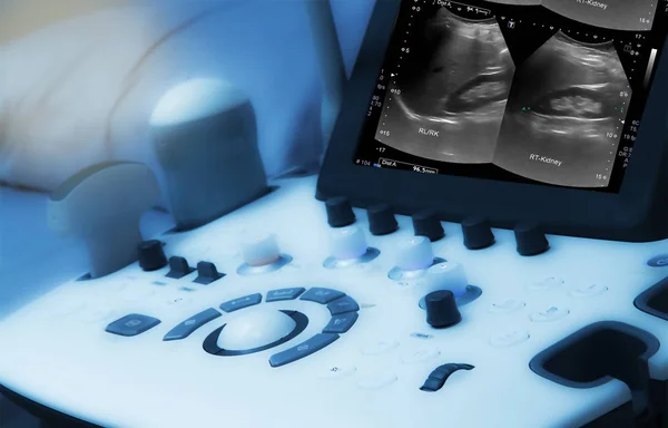 Attrezzatura medica sfondo, close-up ultrasuoni macchina . — Foto Stock