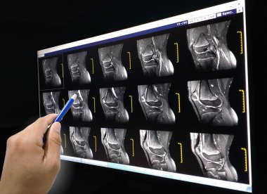 Kapalı el doktoru elinde kalem tutarak hastaya manyetik rezonans (MRI) eklemlerini açıkla..