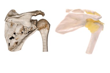 Kırık kürek kemikleri ve kürek kemiği örneği beyaz arkaplan görüntüsü ve kopyalama alanı.