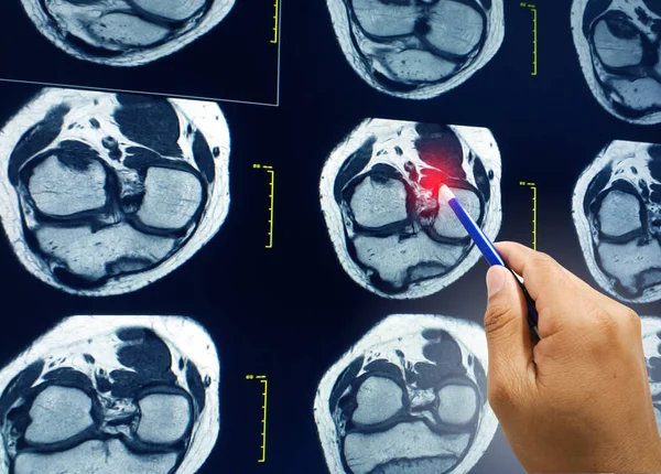 Kapalı Doktoru Elinde Kalem Tutarak Hastaya Manyetik Rezonans Mri Eklemlerini — Stok fotoğraf