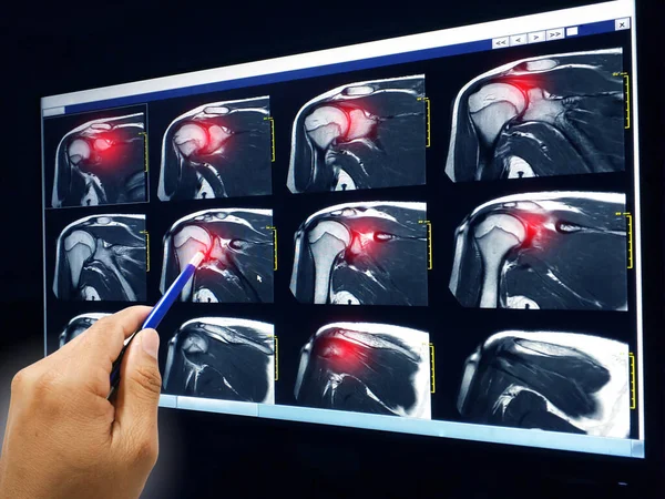 Ponto Médico Mão Ombro Explique Resultados Paciente Para Conhecer Foco — Fotografia de Stock