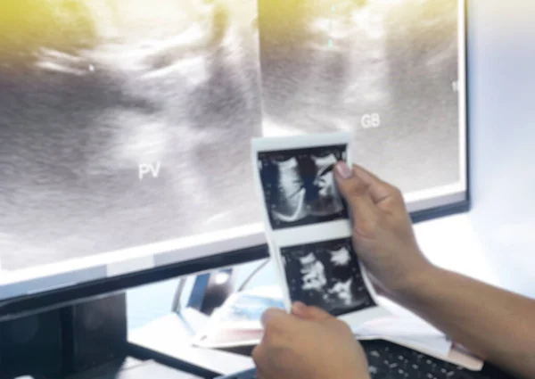 Blurred Close Hand Doctor Examines Ultrasound Images Patient Sonography Health — Stock Photo, Image