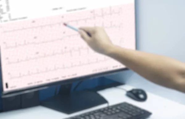 Imagen Borrosa Cerca Médico General Examina Electrocardiograma Del Paciente Durante —  Fotos de Stock