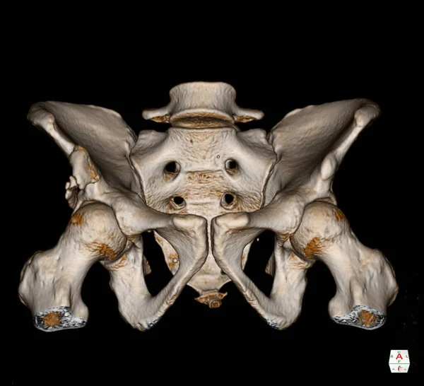 Scan Pelvis Bone 렌더링 이미지검은 배경에 분리되어 있습니다 8Mm 두께와 — 스톡 사진