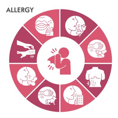 Simgeli Modern Alerji Infographic tasarım şablonu. Beyaz arka planda Alerjen Infographic görselleştirme. Alerjiler sunum için şablona neden olur. Infographic için yaratıcı vektör illüstrasyonu.