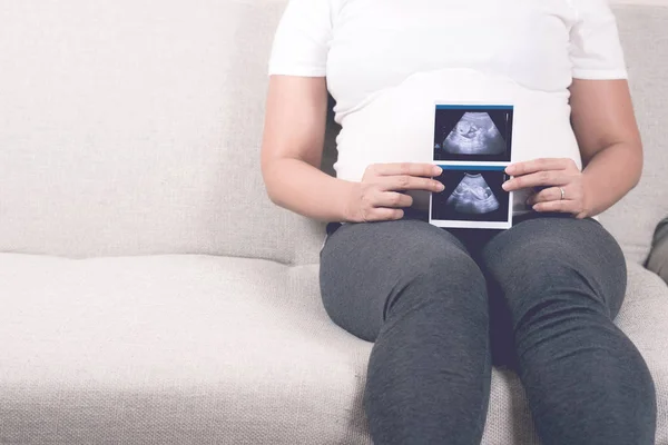 Nieostrość Rozmyte Szczęśliwy Ciąży Kobieta Siedzi Kanapie Domu Trzyma Pokazuje — Zdjęcie stockowe