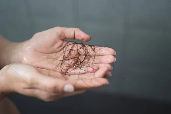 Close Mão Mulher Segurando Queda Cabelo Depois Que Ela Lavar — Fotografia de Stock