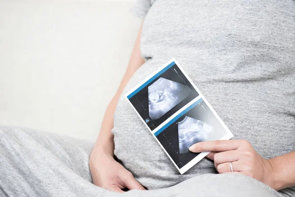 Yumuşak odak ve bulanık oturan mutlu hamile kadının evde kanepenin üzerinde tutarak ve ultrason gösterilen fotoğrafı tarar. Gebelik, Fetal muayene, Doğum öncesi bakım, annelik, sağlık, üst ve sevgi.