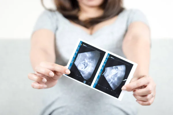 Měkké Zaostření Rozmazaný Šťastné Těhotné Ženy Sedí Gauči Doma Drží — Stock fotografie