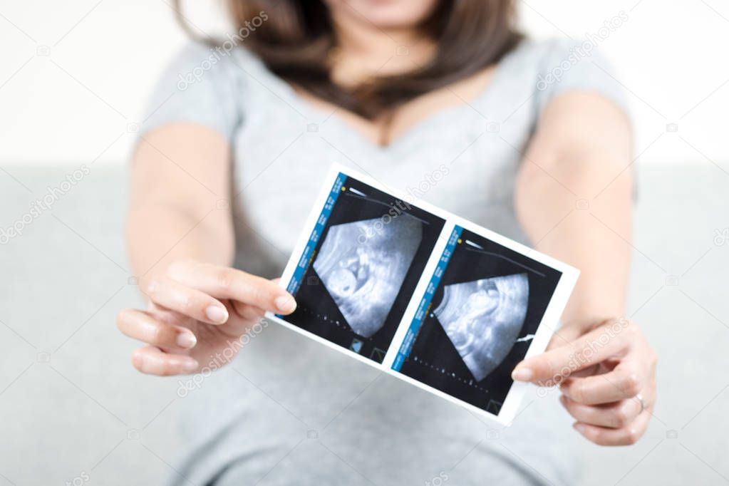 Soft focus and blurry of happy pregnant woman sitting on sofa at home holding and showing ultrasound scan photos of her baby to you. Pregnancy healthcare and parent concept.