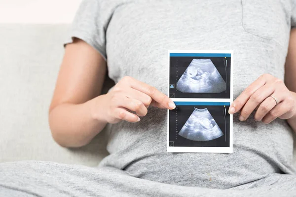 Nieostrość Rozmyte Szczęśliwy Ciąży Kobieta Siedzi Kanapie Domu Trzyma Pokazuje — Zdjęcie stockowe