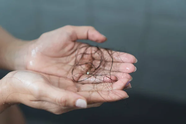 Close Mão Mulher Segurando Queda Cabelo Depois Que Ela Lavar — Fotografia de Stock