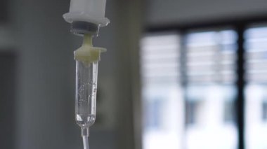 Tuzlu çözeltinin selektif odak damla intravenöz enjeksiyon