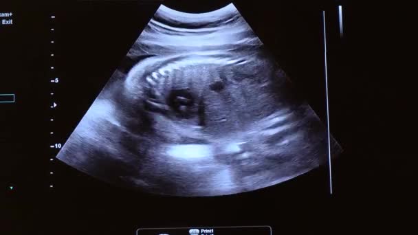 Ultrason Görüntüsünü Haftalık Hamile Kalp Omurga Diyafram Akciğer Böbrek Mide — Stok video