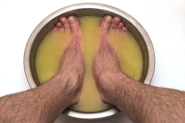 male feet in a basin with mustard soars his legs, on a white natural background