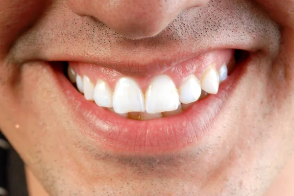 Primer Plano Joven Hombre Ampliamente Sonriente —  Fotos de Stock