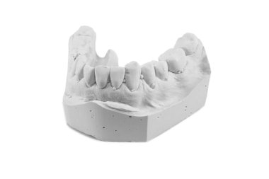 Beyaz arka planda izole protez alçı modeli.