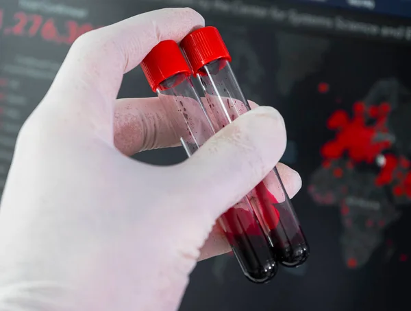 Test tube containing a blood sample, test tube  for Covid-19 coronavirus analyzing. Laboratory testing patients sample over ncov-19 tracker world map