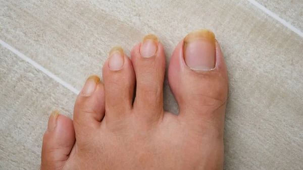 Men Foot Dirty Long Pedicure — Stock Photo, Image