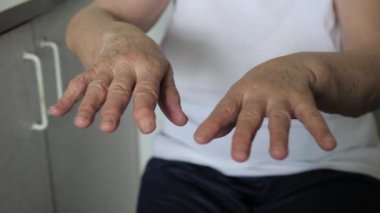 Titreyen ellerde titreme hastalığı olan yaşlı bir kadın kırışıklıkları close-Up