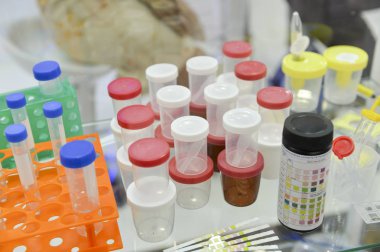 bir bankta plastik Laboratuvar tüpleri