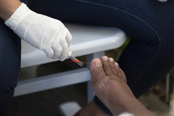 Rio Janeiro Brasil Novembro 2018 Profissional Saúde Examina Paciente Diabético — Fotografia de Stock