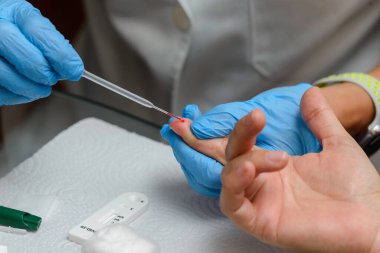 Doktor viral hastalık için test kiti hazırlıyor. COVID-19 nCoV. Coronavirus için laboratuvar kartı testi. COVID-19 hızlı test