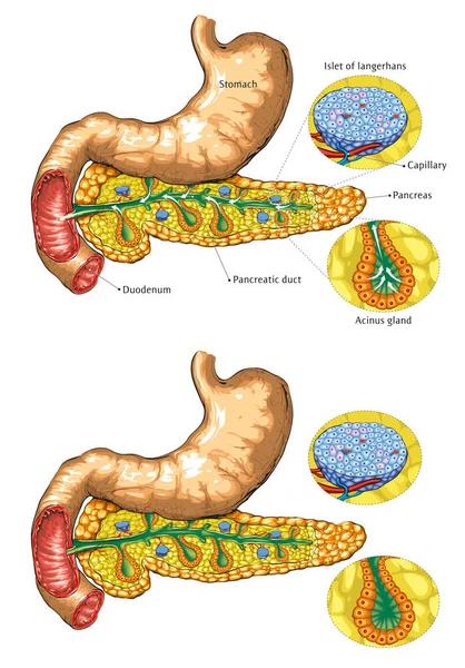 Ilustração Vetorial Anatomia Pâncreas —  Vetores de Stock