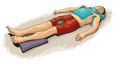 Vector illustration of  first aid at sun stroke or heat stroke. clipart