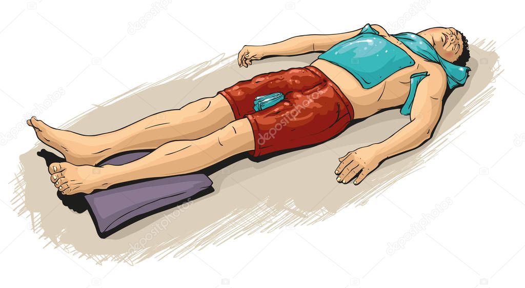 Vector illustration of  first aid at sun stroke or heat stroke.