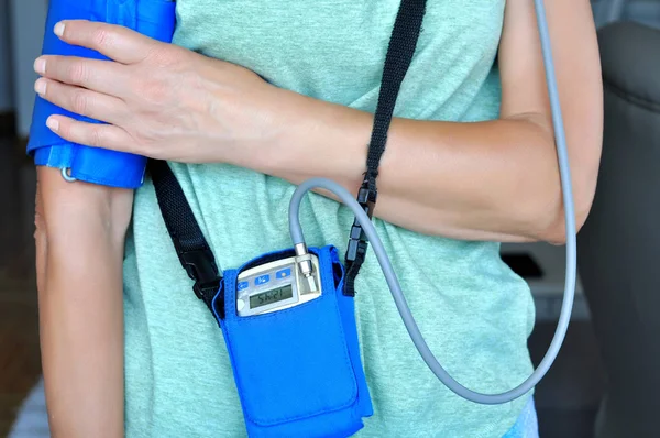 Mujer Que Usa Dispositivo Monitor Holter Para Monitorear Diariamente Electrocardiograma — Foto de Stock