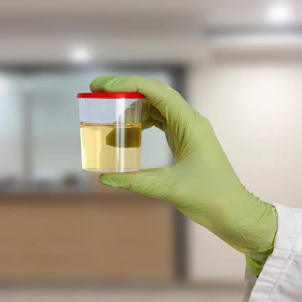 Doctor Holding Container Urine Sample Hand — Stock Photo, Image