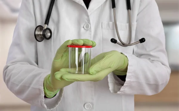 Dokter Bedrijf Lege Container Urine Sperma Monsters Handen — Stockfoto