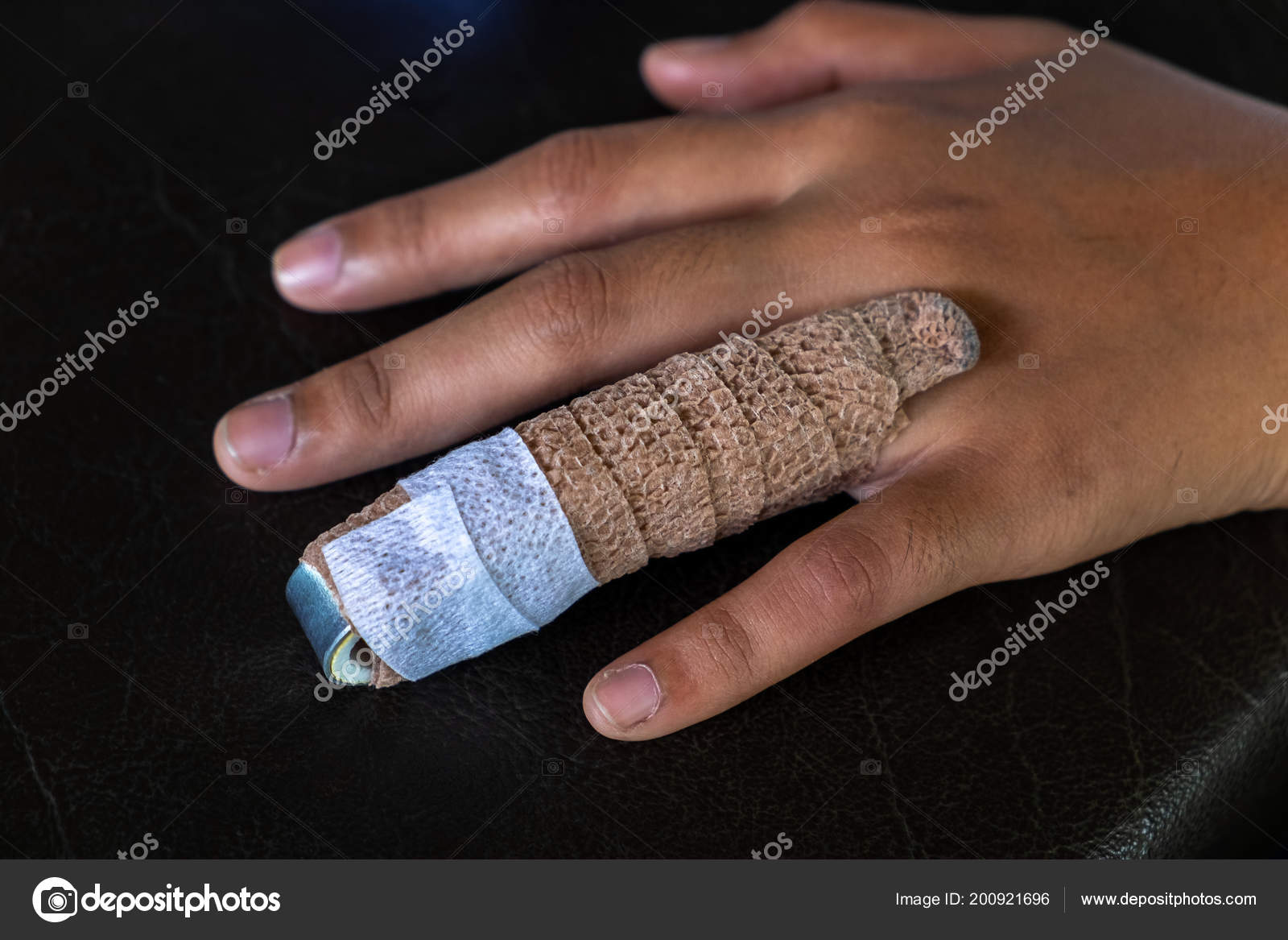 Amazon.com: 10pcs Oval Finger Splint, 5 Sizes Finger Splint Ring Oval Finger  Splint Support 5 Oval Finger Splints & 5 Finger Compression Sleeves For  Thumb Middle Pinky Ring Finger Index (Black) : Baby