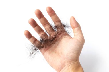 Saç dökülmesi sorunu, saç yardım Closeup düşmek beyaz arka plan üzerinde.