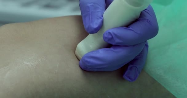 Médico Orienta Sensor Longo Superfície Joelho Durante Ultrassom Usando Laser — Vídeo de Stock