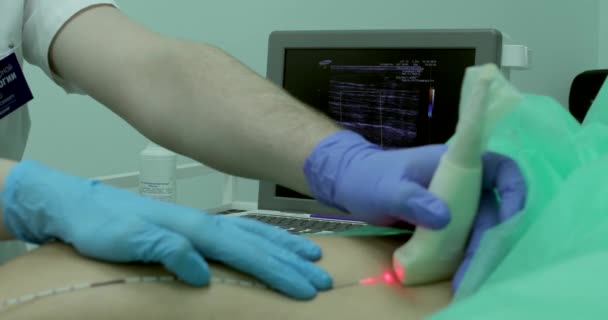 Médico Orienta Sensor Longo Superfície Joelho Durante Ultrassom Usando Laser — Vídeo de Stock