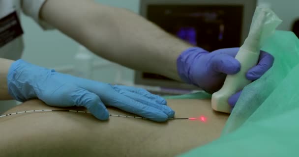 Médico Orienta Sensor Longo Superfície Joelho Durante Ultrassom Usando Laser — Vídeo de Stock