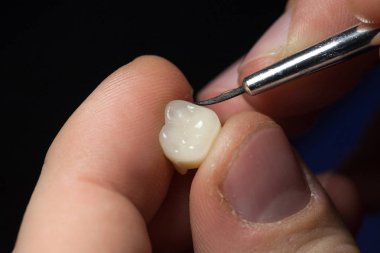 Diş teknisyeni veya diş protez onun laboratuvarda çalışan diş hekimi. Dişlerin estetik boyama