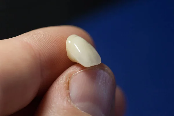 Técnico Dental Dentista Que Trabaja Con Dentaduras Postizas Laboratorio Colorante —  Fotos de Stock