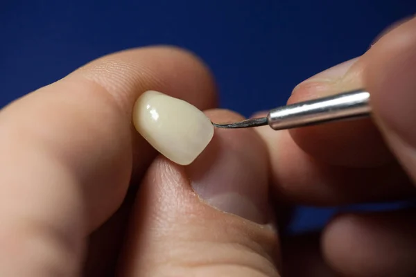 Técnico Dental Dentista Que Trabaja Con Dentaduras Postizas Laboratorio Colorante —  Fotos de Stock