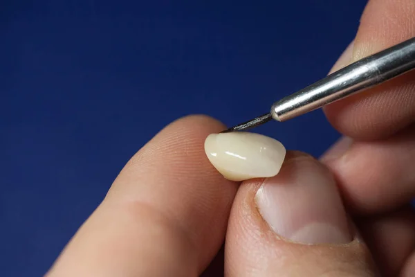 Técnico Dental Dentista Que Trabaja Con Dentaduras Postizas Laboratorio Colorante —  Fotos de Stock