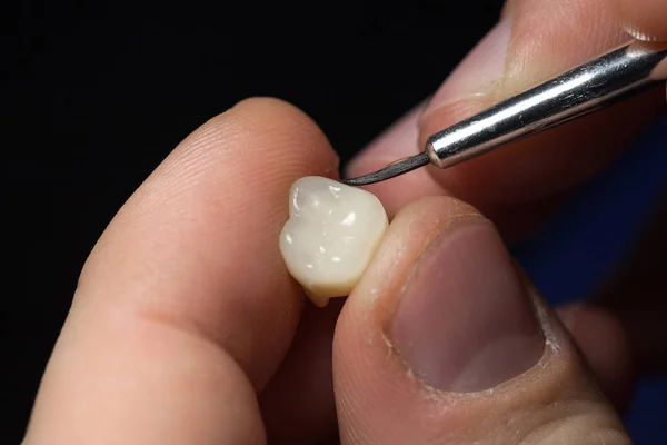 Técnico Dental Dentista Que Trabaja Con Dentaduras Postizas Laboratorio Colorante — Foto de Stock