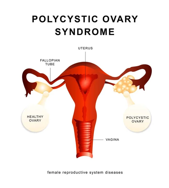 Vrouwelijke Reprodactive Systeem Vagina Platte Vector Illustratin Eps — Stockvector