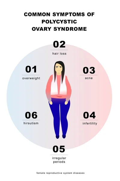 PCOS Symptomen infographic. Hirsutisme. Acne. Vector illustratie. EPS 10 — Stockvector